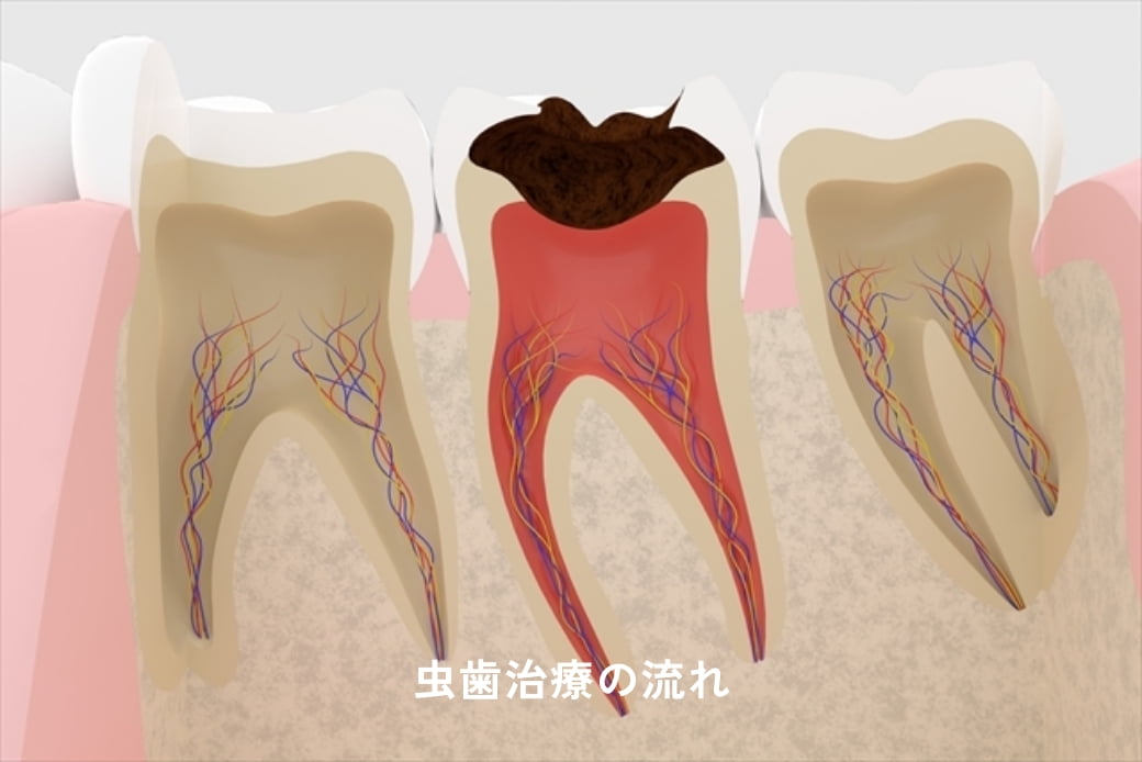 治療説明動画